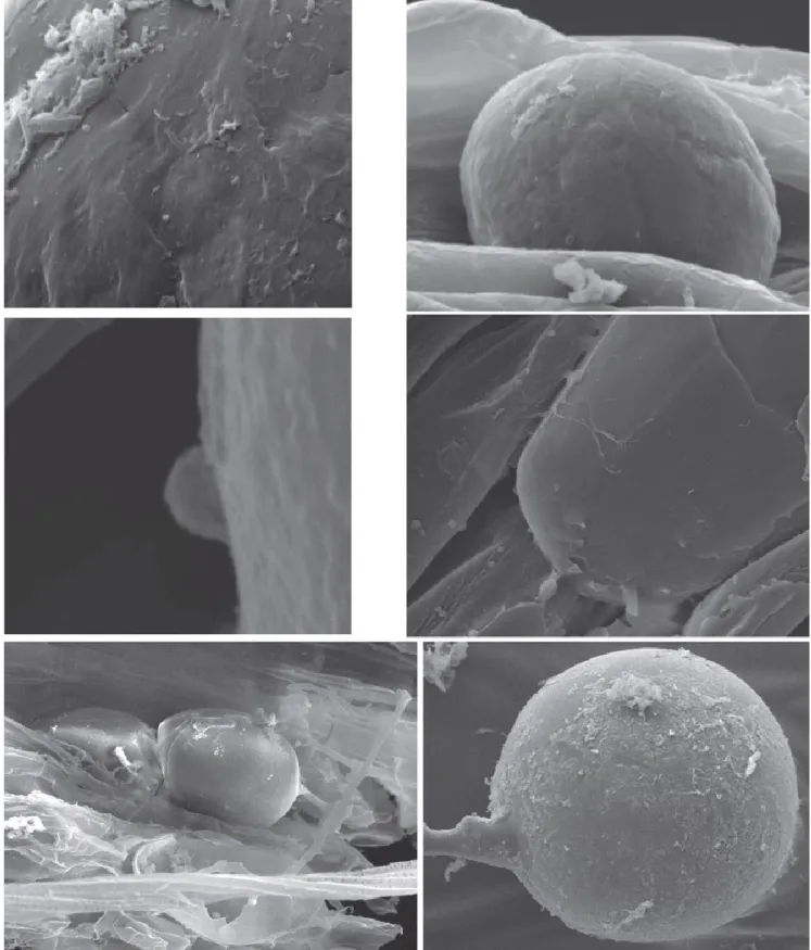 Figure 5    AMF colonized root of Solidago rugosa growing in petroleum contaminated soil was sampled and prepared for 