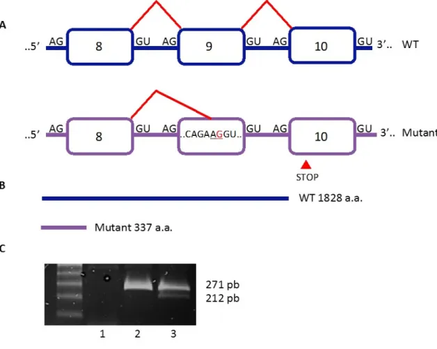 Figure 3.1.1 Analyse in vitro de l’impact d’une mutation silencieuse dans le gène 