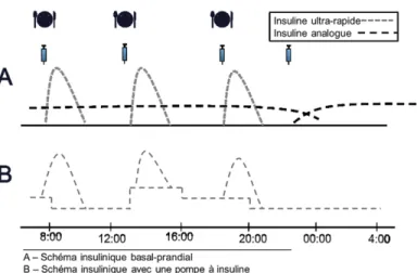 Figure 3. Schéma insulinique basal-prandial aux injections multiples et à la pompe.© Rémi Rabasa-Lhoret, cours  NUT6027 