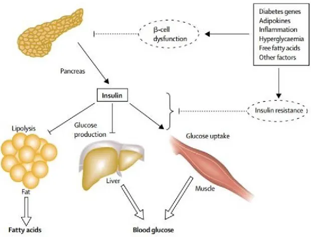 Figure 3: Pathophysiology of hyperglycaemia and increased circulating free fatty acids, “Figure  reused with permission of the rights holder, Elsevier, see appendix 1” (Stumvoll et al., 2005)