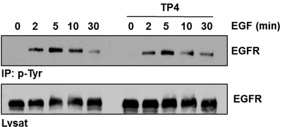 Figure  3.8.  La  phosphorylation  de  l’EGFR.  Une  immunoprécipitation  (IP)  des  protéines  phosphorylées  en  tyrosine  a  été  effectuée  à  l’aide  de  billes  couplées  à  un  anticorps   anti-phosphotyrosine (Clone 4G10) à partir de lysats de cell