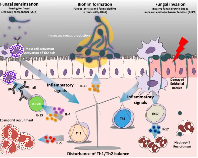 Figure  4.  Réponse  immunitaire  de  l’hôte  souffrant  d’asthme  sévère  avec  sensibilisation  fongique  ou  aspergillose  bronchopulmonaire  allergique  face  à  une  infection  fongique