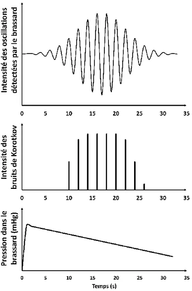 Figure 2 : Relations entre l’oscillométrie et la méthode auscultatoire 