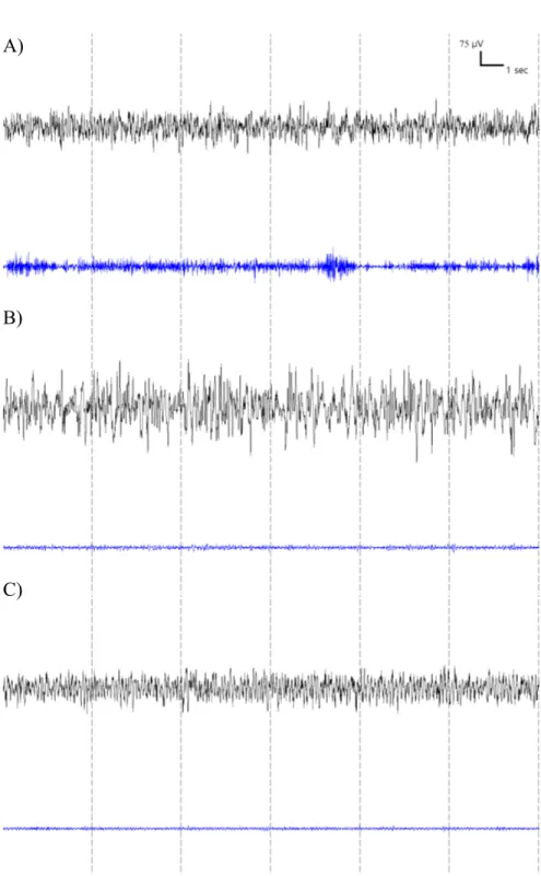 Figure 3.5 – Representative 24-sec EEG and EMG traces for each vigilance states of WT mouse