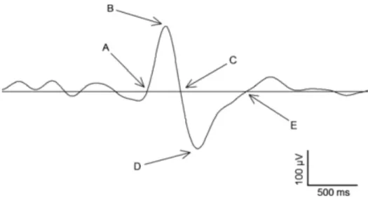 Figure 1.3. Caractéristiques des ondes lentes. 