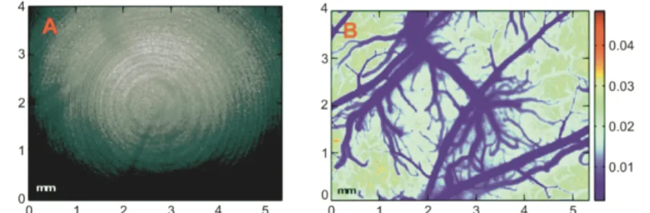 Figure 7. High resolution image of rat brain vasculature using laser speckle contrast