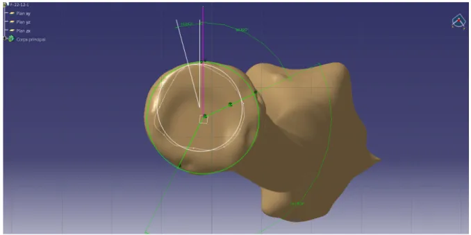 Figure 12: Reconstruction et mesure des angle d'intérêts avec le logiciel CATIA©. 