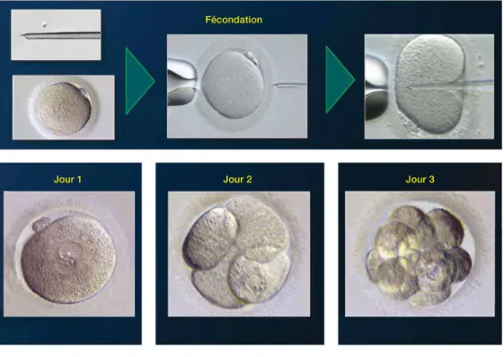 Figure 6.   Évolution	
  de	
  la	
  croissance	
  embryonnaire	
  in	
  vitro	
   Image	
  ©	
  Dr.	
  J.	
  Herrero	
  Garcia,	
  provided	
  by	
  EMD	
  Serono,	
  Canada	
  