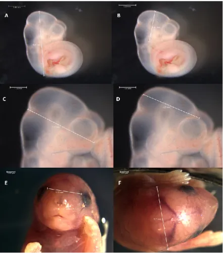 Figure 12.  Mesures  prises  lors  de  la  dissection  des  embryons  au  jour  E10.5