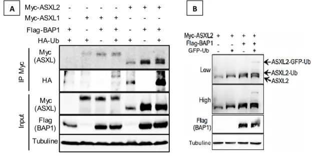 Figure 8 : ASXL2 est modifiée par ubiquitination, et sa co-expression avec BAP1 augmente son  niveau d’ubiquitination