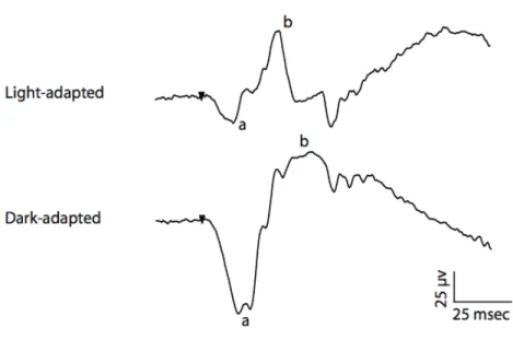 Figure  8-1:  The  human  ERG  recording  in  scotopic  and  photopic  condition  using  short  stimuli of 10 microseconds