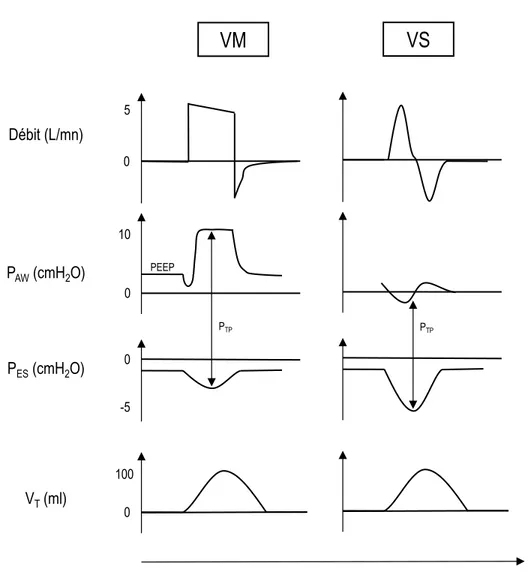 Figure	3	:	Physiologie	de	la	ventilation	mécanique.	