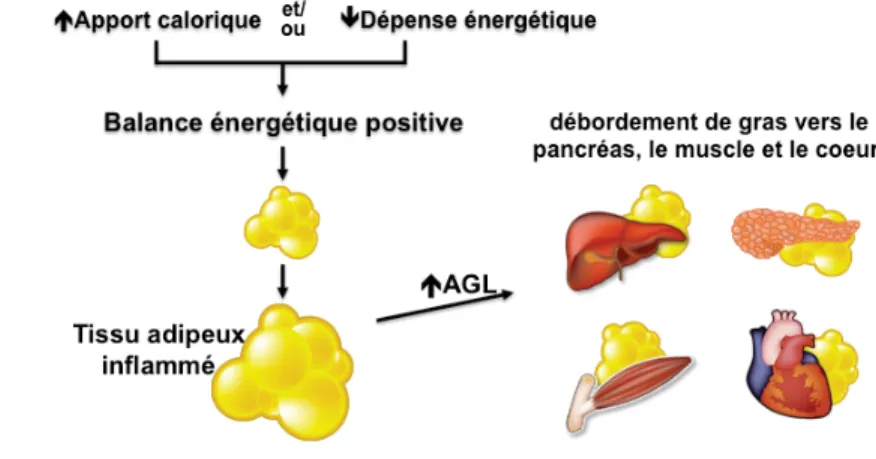 Figure 4. Mécanisme d’accumulation du gras ectopique AGL : acides gras libres
