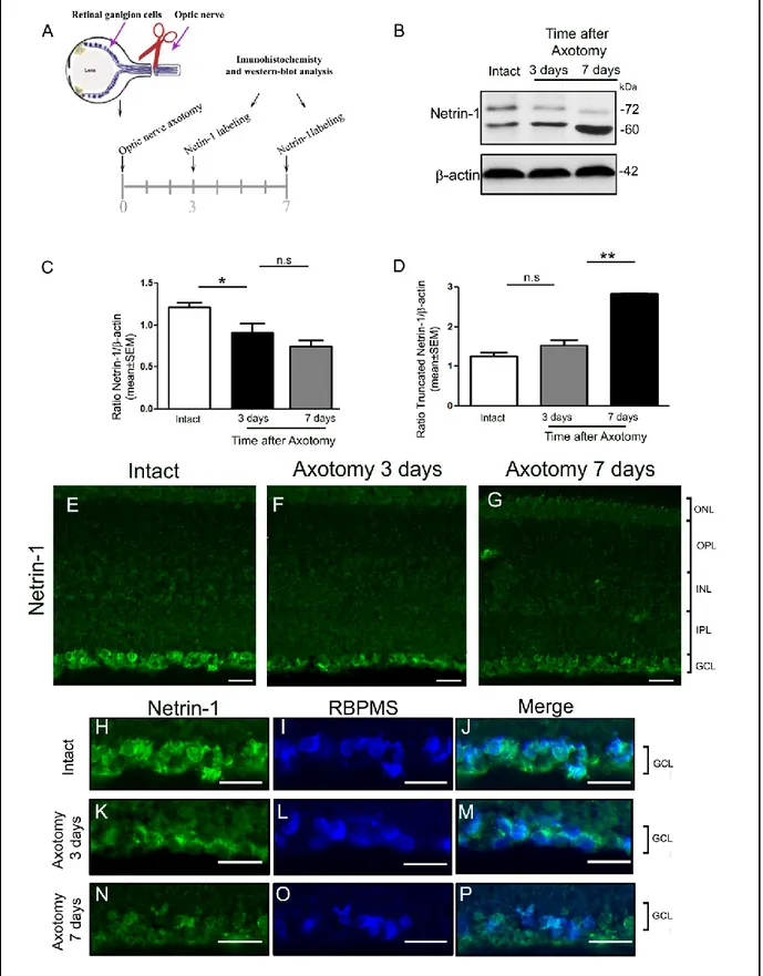 Figure 6. Netrin-1 level decreases after optic nerve axotomy. (A) Outline of the experimental protocol used to 