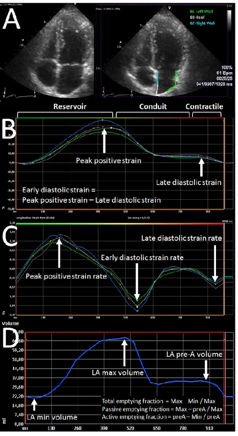 Figure 3. Left atrial  strain, strain rate and phasic volumes by speckle- speckle-tracking  echocardiography 