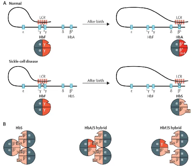 Figure 5.  Hemoglobin production and sickle cell disease.  