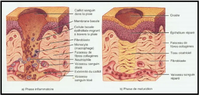 Figure 1.  Exemple de guérison d’une plaie par excision 