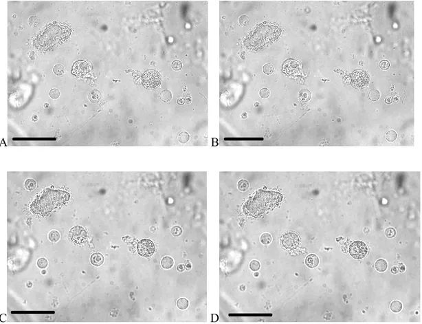 Figure 8: Groupe de cellules dissociées de l’intestin de A.aegypti exposées à 25 μg/ml de  Cry4Aa dans la solution Ae, à t 0  (A), t 5min  (B), t 10min  (C) et t 60min  (D)