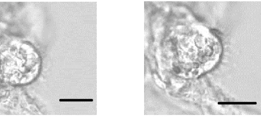 Figure  9:  Image  plus  détaillée  (par  zoom  électronique)  d’une  cellule  dissociée  de  l’intestin de larve de A