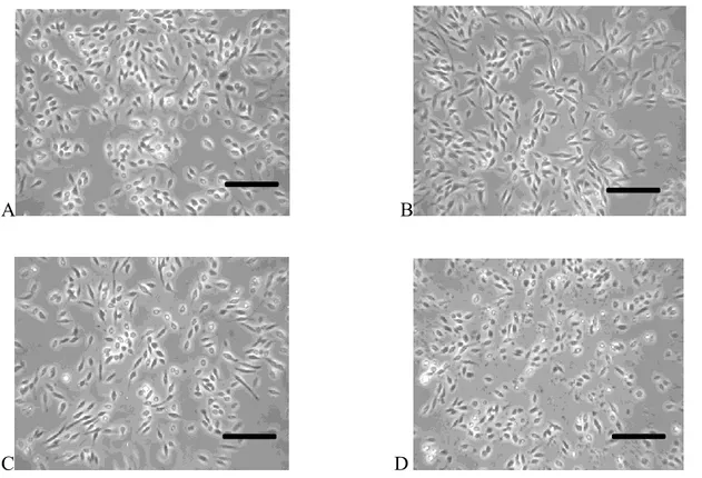 Figure 11 : Cellules Ag55 dans la solution Ag sans toxine pendant 24 h au t 0  (A), t 30min  (B), t 60min  (C) et t 24h  (D)