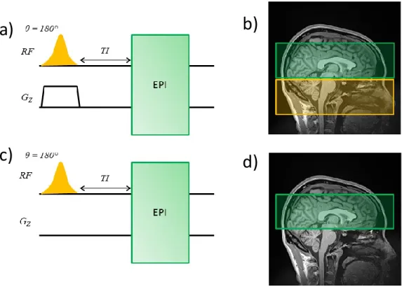 Figure 15: Illustration of a PICORE-type PASL technique. a) Simplified pulse sequence diagram of the tagging experiment  used in a PICORE sequence