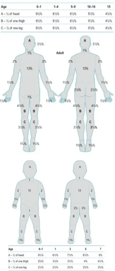Figure 1 Échelle de Lund et Browder : modèles adulte (haut) et enfant (bas) (Tiré de: Herndon DN, ed