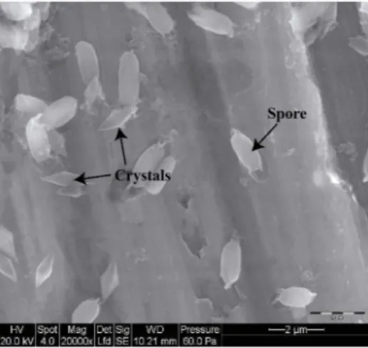 Fig. 1. Spores and parasporal crystals of Bacillus thuringiensis from strain H29.3 (5)