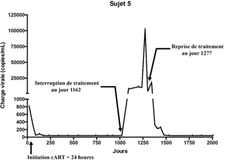 Figure 10:  Rebond viral du Sujet 5 à 3 ans d’âge.  