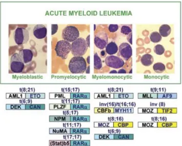 Figure 3 : Mutations associées au développement de différents sous-types de LMA 