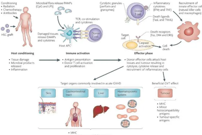 Figure 4 : Développement de la aGVHD 