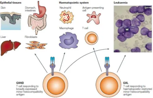 Figure 6 : Paradoxe entre GVHD et GVL 