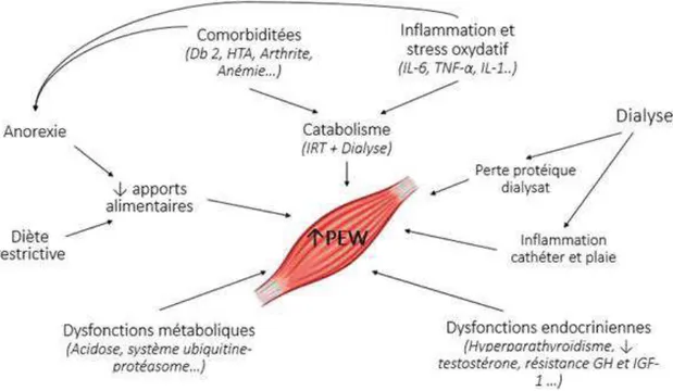 Figure 5 : Catabolisme musculaire et insuffisance rénale chronique [123] 