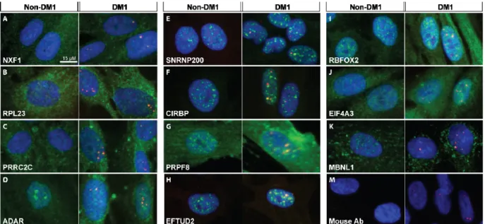 Figure 6. Various localization patterns are observed among RBP candidates that co- co-localize with CUG foci