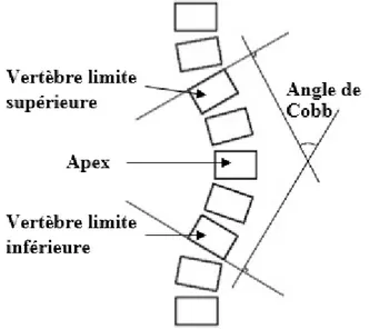 Figure 4. Schéma représentant la mesure de l’angle de Cobb. Adaptée de Cobb (1948). 