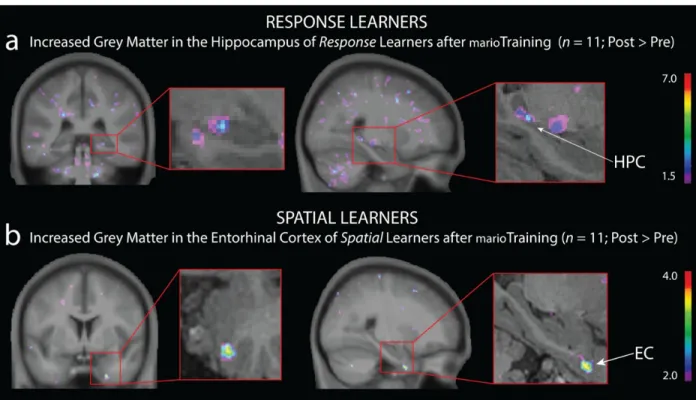 Fig.  4.  Active  control  group  showing  the  impact  of  90  hours  of  laboratory-controlled  3D- 