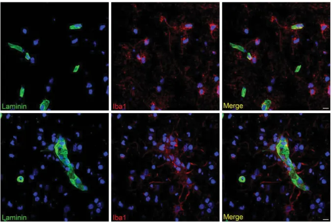 Figure 3 – Microglial interaction with the CNS vasculature. Human brain microglia (Iba1, 