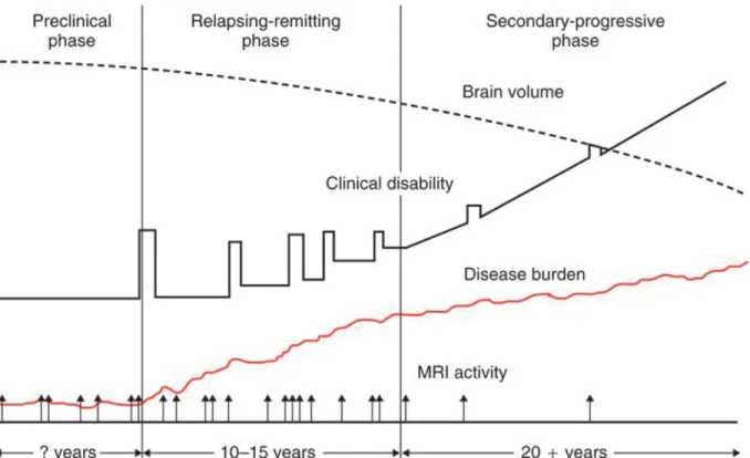Figure  8  –  Graphical  representation  of  the  clinical  disabilities,  disease  burden,  brain  volume and MRI activities of a mock average RRMS patient