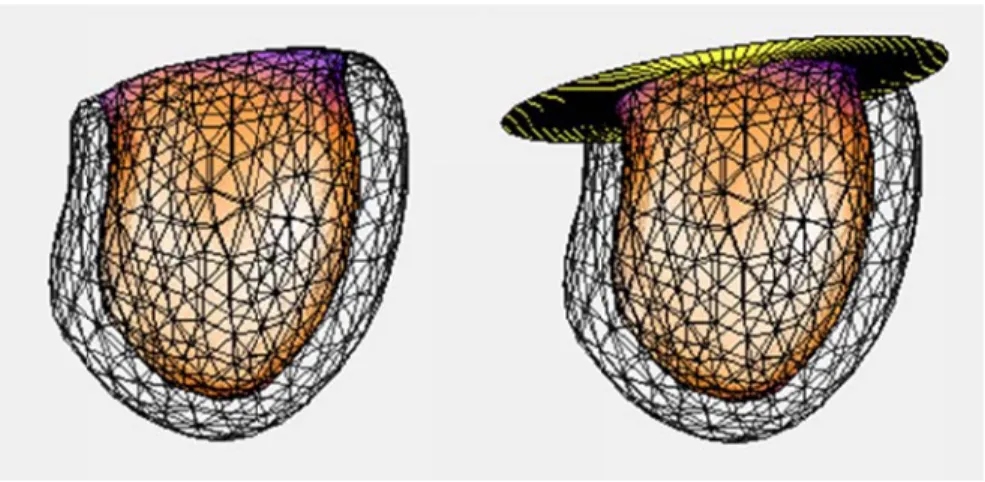 Figure 5.  epicardiu surface re O either th in myoc of an o resolutio image m within  maximu or chan local thi relative  Dynamic surf um are shown aespectively