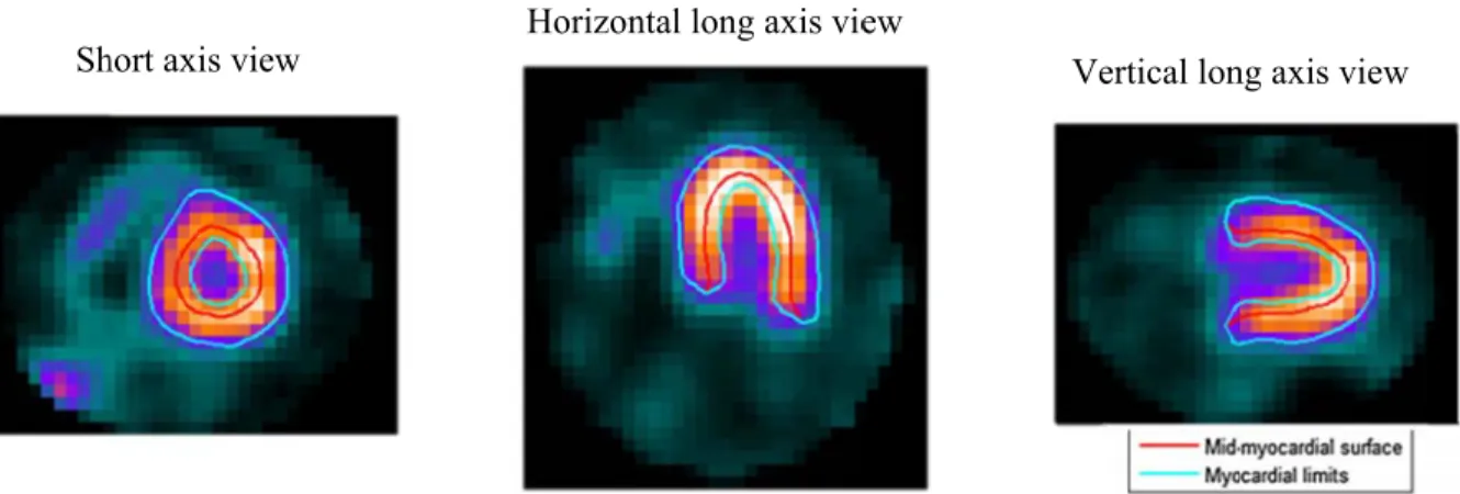 Figure 6. A function into a s mechan each mi phase a followin describe Fourier a As discu to each  time-ba to be co into the of the s Sh An example oAgain as p n (maximumsinusoidal  fnical contrac id-myocardiaand amplitudng sections, ed