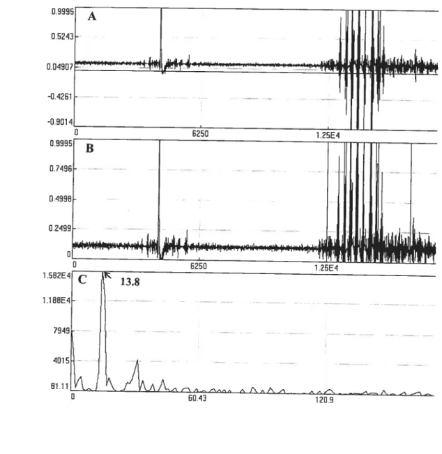 Figure 3-2: Tremor signais in oxotrernorine injected rats. A shows a pattern offtequency