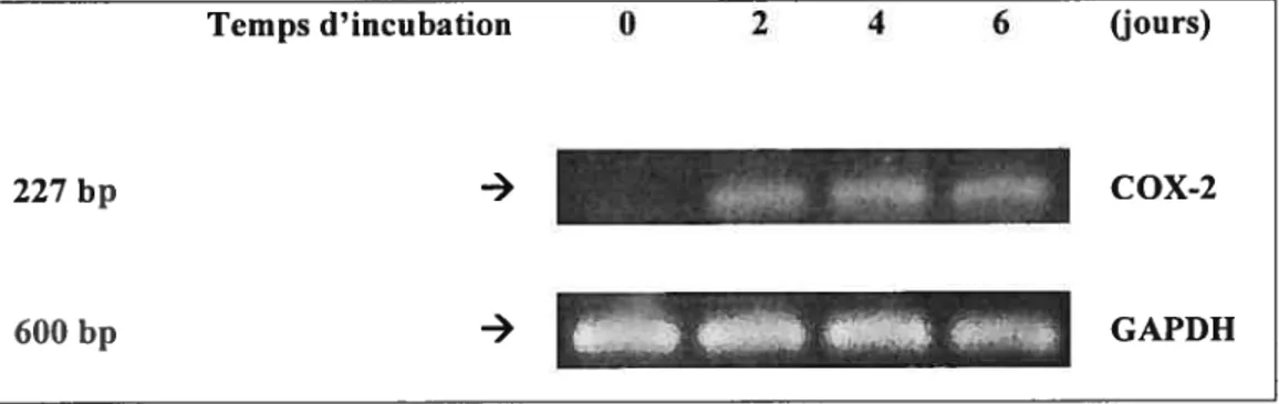 Figure 3.7 L’expression des ARNm de la COX-2 par RT-PCR