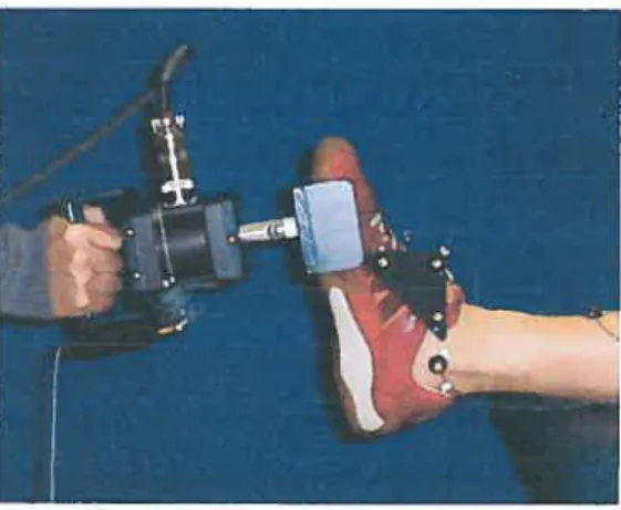 Figure 7: The evaluator applïed a tangential force on the foot wïth a triaxial dynamometer during EPM assessment ofthe ankle.