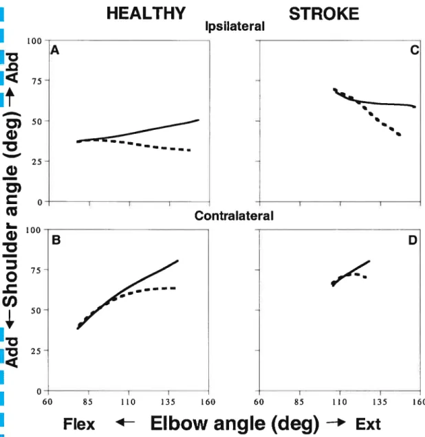Figure 5: Typical traces of (mean) interjoint coordination pattems between the elbow (flexionjextension) and the shoulder (horizontal adduction/abduction) for free-trunk (dashed unes) and blocked-trunk (solid unes) conditions in one healthy subject (A,C) and one participant with hemiparesis (H7; B,D) for reaches to the ipsilatéral (A,B) and contralateral (C,D) targets.
