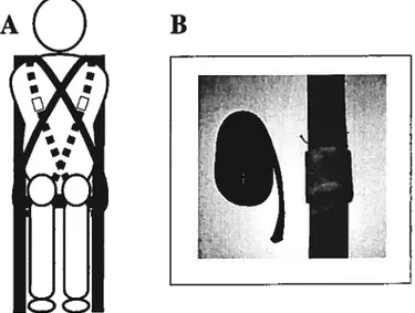 Figure 1 : A - Ceintures vues de face, B — Boucle et sangle