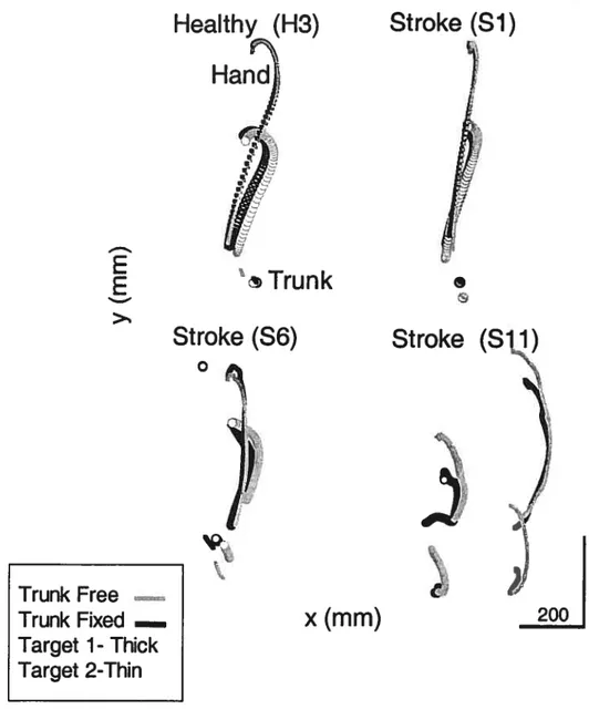 Figure 2 Endpoint (Hand) and Ttunk trajectories viewed f rom above (x-y plane) for a healthy individual (H3) and hemiparetic patients with mild (Si), moderate (S6) and severe (Si 1) severity