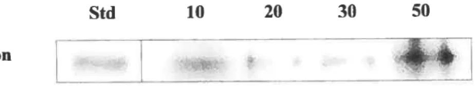 Figure 5. Expression de la protéine Gas6 dans le poumon telle que détectée par l’anticorps anti-Gla