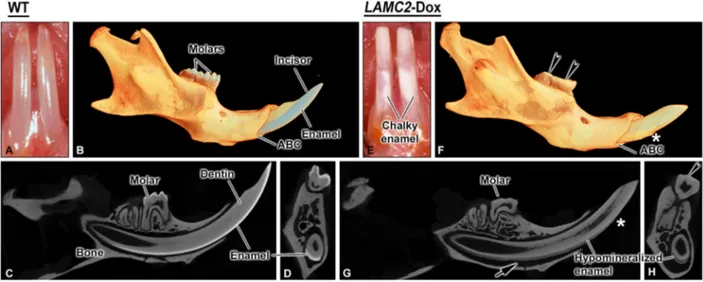 Fig. 1. Comparative micro-CT views of hemimandibles from wild type (WT, A-D) and human LAMC2-rescued transgenic mice (LAMC2-Dox) (E-H) mice