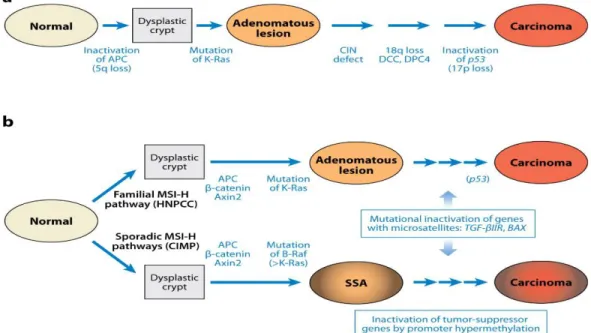 Figure 1. Les modèles génétiques du cancer colorectal 