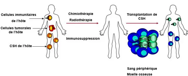 Figure 1. 4 La transplantation de cellules souches hématopoïétiques 
