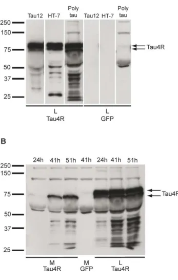 Figure 1. Overexpressed human tau in Hela cells is found in the culture medium. (A) In the  cell lysate (L) prepared from Hela cells overexpressing human tau fused to the GFP tag, a  tau- positive band just above 75 kDa and a band at 75 kDa corresponding t